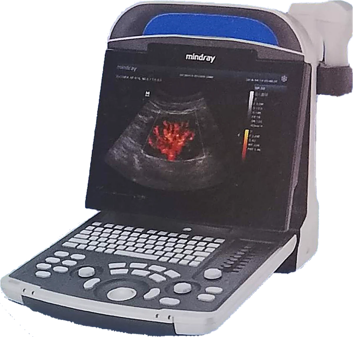 Mindray DP-30 Power Doppler